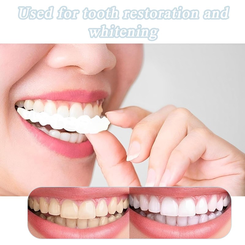 False Teeth Veneers Top and Bottom,Veneers Teeth,Clip on Veneers Top