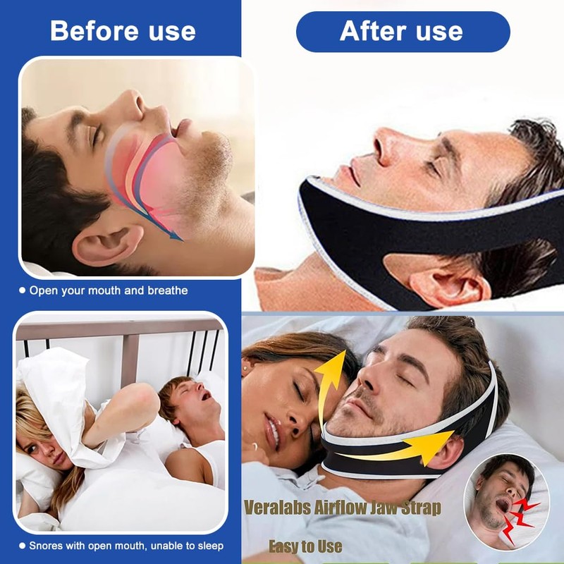 FDEETY Snoring Stopper Anti Snoring Chin Strap Sleeping Open Breathing