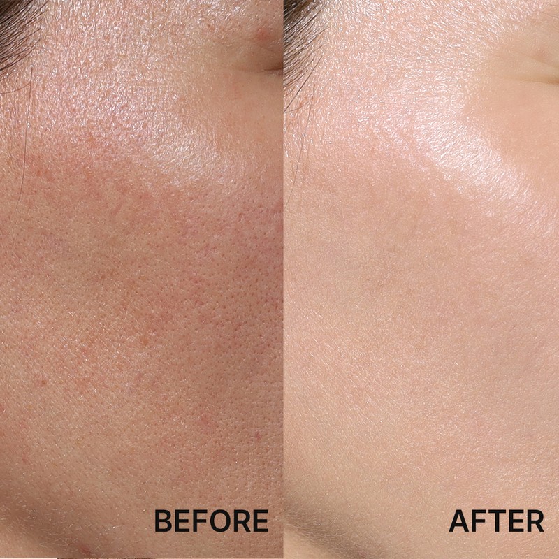 Trimai (self-produced product) TriMy Recovery 3 in 1 Pept CC