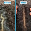 Umberto Giannini Scalp Restore Shampoo & Conditioner Duo, Vegan &