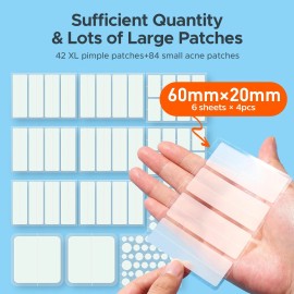 TKTK Large Pimple Patches for Face, 7 Sizes XL Acne Patches, Big Hydrocolloid..