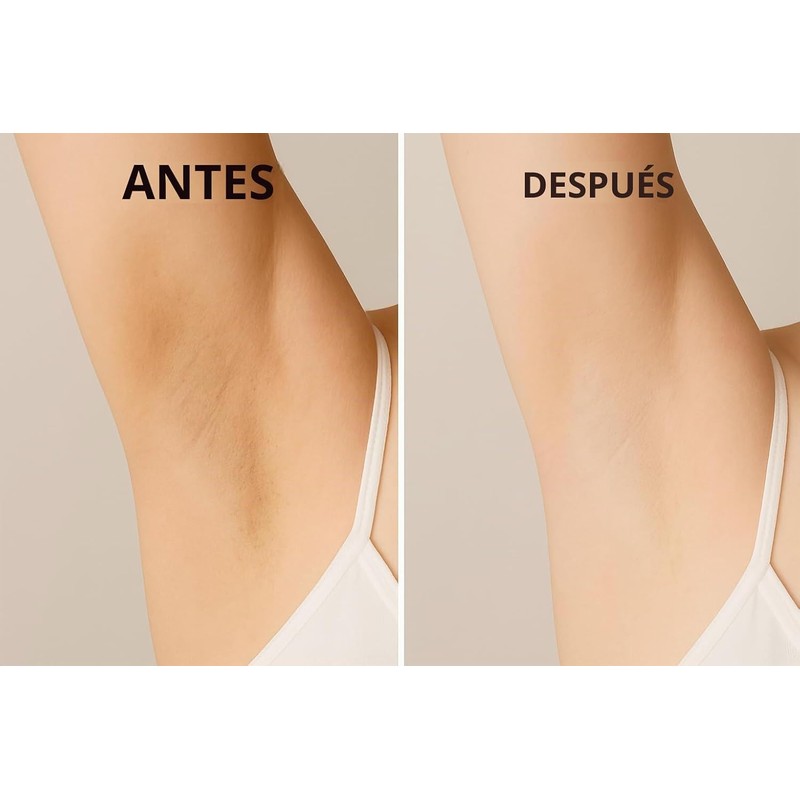Crema iluminadora avanzada para axilas con ácido kójico Glutatión Ácido
