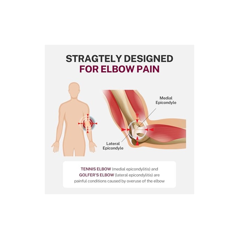Fitomo Codera Epicondilitis, coderas para tendinitis Tenis y Golfista con