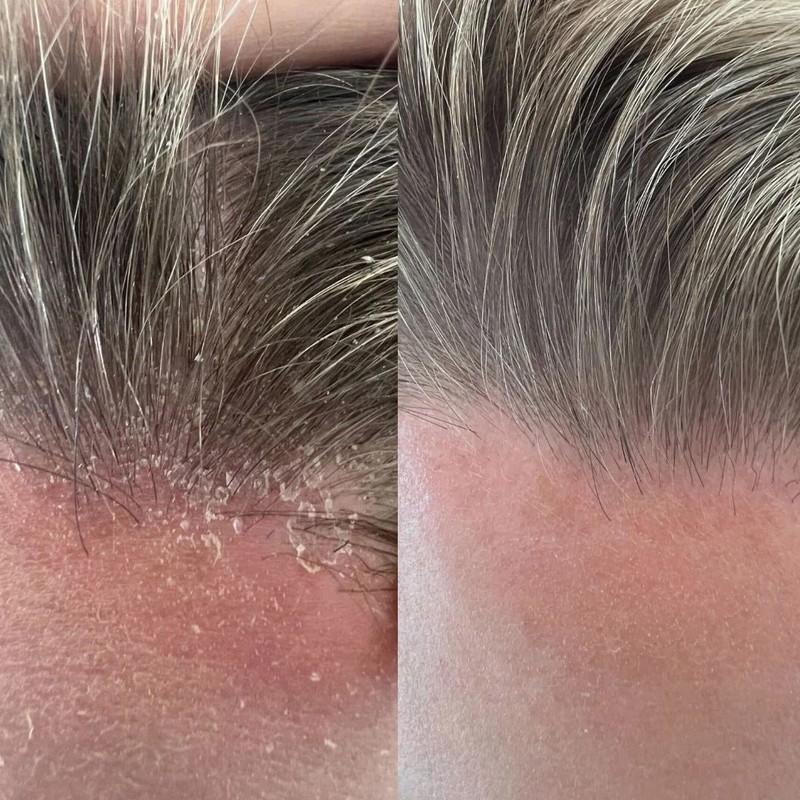 STRAAND Crown Cleanse Shampoo Trio Bundle