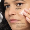 The Ordinary Azelaic Acid Suspension 10%, Formula for Uneven and