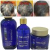 Set Anti Caída Shampoo Y Tratamiento Terramar + Gel