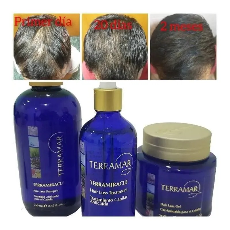 Set Anti Caída Shampoo Y Tratamiento Terramar + Gel