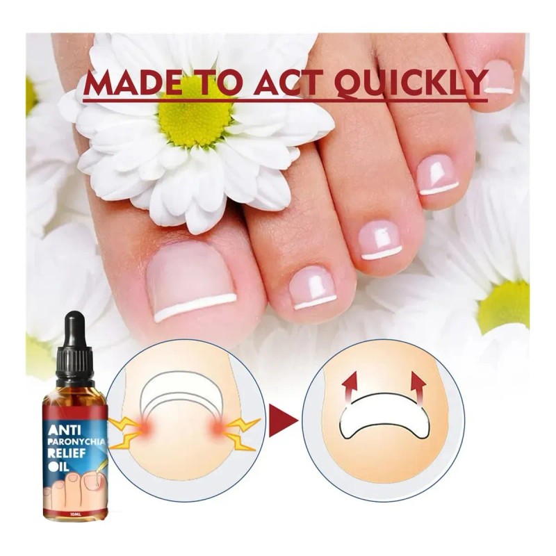 Cepillo De Abejas Generic Zanaquick Antihongos Uñas