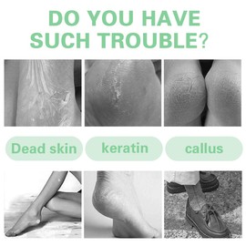 Hornhautentferner, Fußschleifer, Pediküre Pediküre spezielle Hornhautschleifer, wasserdicht tut nicht weh die Haut, für die Fußpflege (Obst grün)