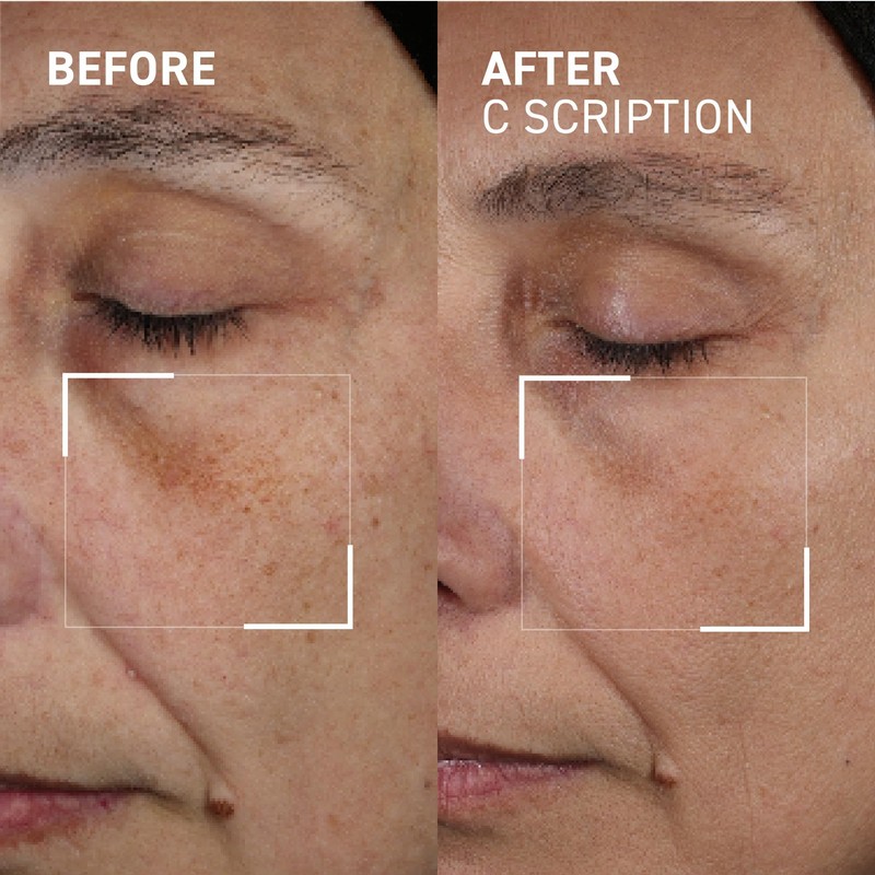 Dr. Brandt Bright This Way C Scription - Concentrated Vitamin