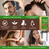 Batana Oil Shampoo, Batana Shampoo with Rosemary Extract, Champú De
