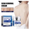 Cremas Para Cicatrices Profundas