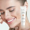 Crema Despigmentante Para Manchas, Melasma Y Paño Exel 30ml Vegana