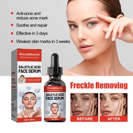 Salicylic Acid Serum For Acne, Blackhead & Open Pores, Refreshing Facial Essence Moisturizer Mild Exfoliating Salicylic Acid for All Skin Types