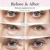 Under Eye Patches, Collagen Masks for Puffy Eyes, Dark Circles,