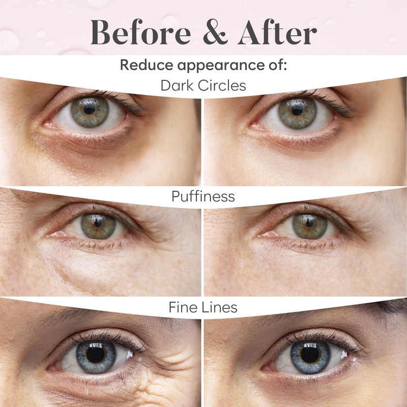 Under Eye Patches, Collagen Masks for Puffy Eyes, Dark Circles,