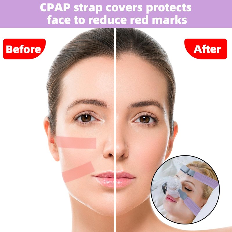 6 Packs Satin CPAP Strap Covers Soft, CPAP Mask Cushions,