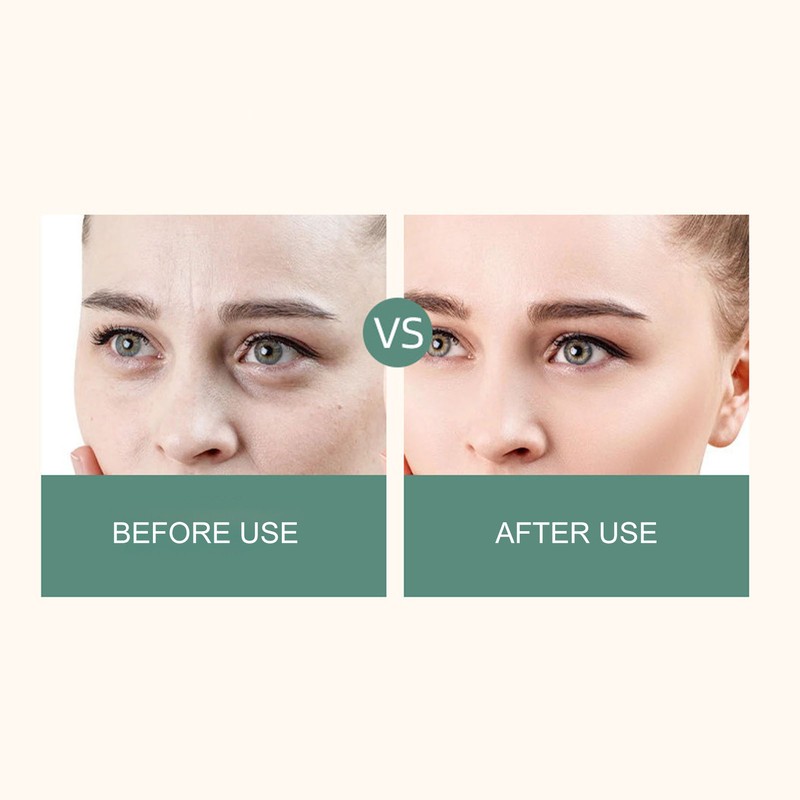 Facial Oxygen Injector Fine Mist Deep Moisturizing High Pressure Handheld