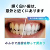 (New Habit of Getting Beautiful Teeth) Whitening Sheet, 1 Bag