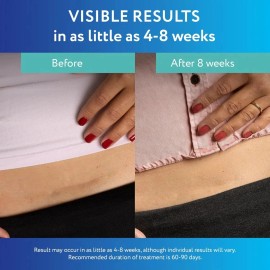 Parche Para Las Cicatrices Scar Away 3 Meses 10 Hojas