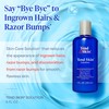 Tend Skin Solution for Unsightly Razor Bumps, Ingrown Hair and