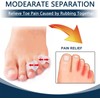 Toe Separators, Gel Toe Separators, Small Bunion Corrector to Prevent