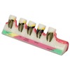Dental Teeth Model Ceramic Clear Structure Oral Care Educational Periodontal