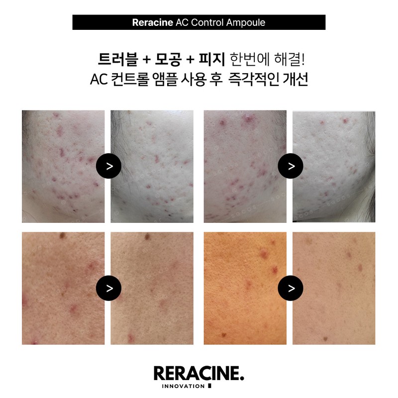 Lyricin | Hyaluronic Cream 80ml x 2 Hyaluronic Cream 80ml
