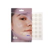 ISNTREE Parches para Imperfecciones Onion Newpair Spot Patch Basic -