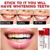 Pack of 2 Sp-4 Toothpaste, Sp-4 Probiotic Toothpaste, Whitening Toothpaste,
