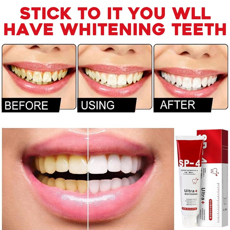 Pack of 2 Sp-4 Toothpaste, Sp-4 Probiotic Toothpaste, Whitening Toothpaste,