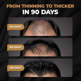 SPARTAN Champú Activador De Raíces Para Hombres: Champú Para El Crecimiento Del Cabello Para La Caída Y El Debilitamiento Del Cabello Negro