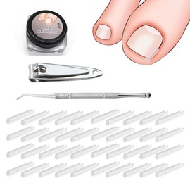 TSUOUKLSet zur Korrektur eingewachsener Zehennägel - 40 Stück schmerzfreie Zehennagelglättungsstreifen mit Zehennagelheber - einfaches Werkzeugset für eingewachsene Zehennägel（+Nagelknipser）