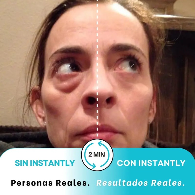 Instantly Ageless Jeunesse - Bolsa 5 Viales Remueve Arrugas