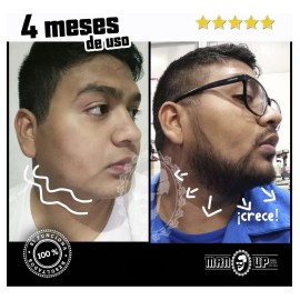Roll On Manup Crecimiento Barba Y Cabello 6 Unidades