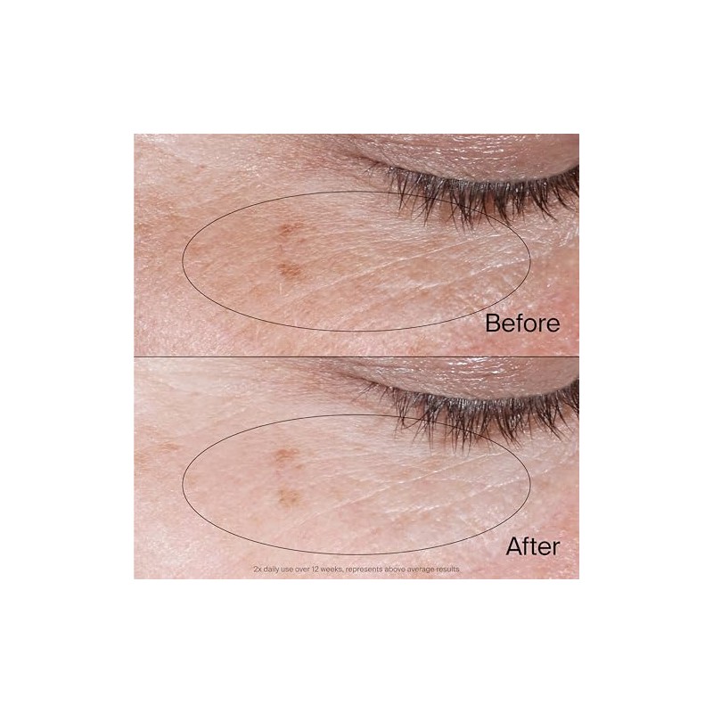 Neutrogena Collagen Bank Crema Ojos Revitalizante Debajo Ayuda Preservar Colágeno