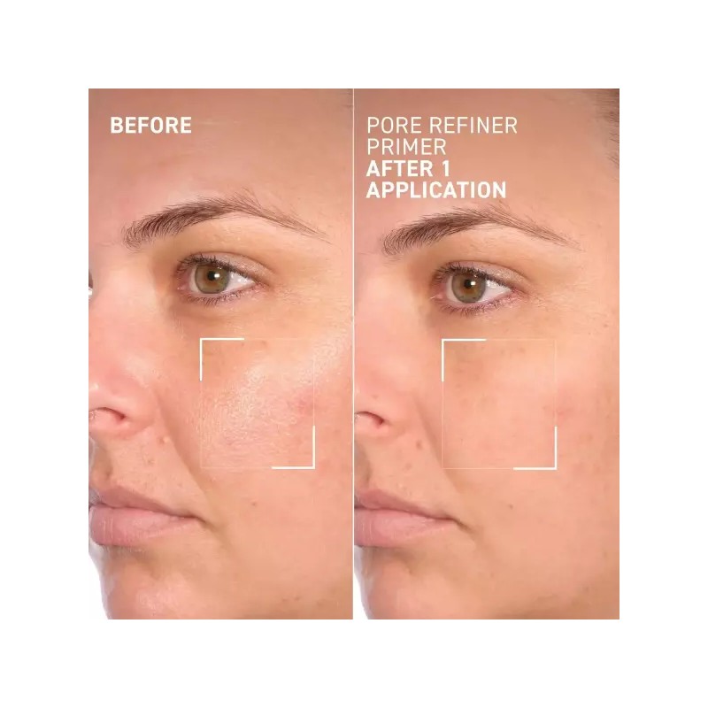 Dr. Brandt Skincare 닥터 브랜트 모공은 이제 사라졌습니다 리파이너 프라이머