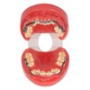 Professional Dental Demonstration Orthodontic Model with Metal Wires and Bracket