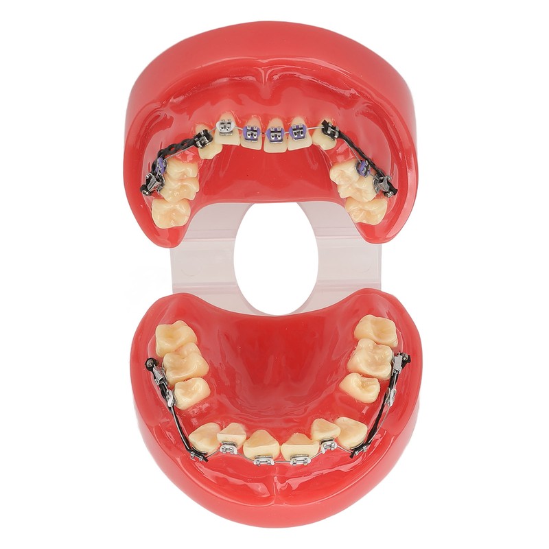 Professional Dental Demonstration Orthodontic Model with Metal Wires and Bracket