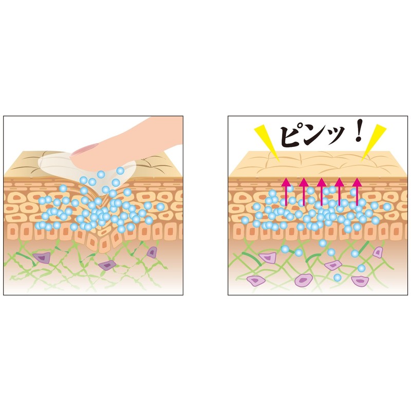 na-zuruinpakutoripea [Knight Pack]