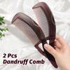 Sularpek 2 Pcs Dandruff Comb, Scalp Comb for Dandruff, Scalp