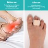 20 Stück Hammerzehen Korrektoren,Hammerzehen Korrektur,Hammerzehenschienen,Gebrochene Zehenschiene,Zehenkorrektor,Zehenbandagen zur Korrektur von Hammerzehen,Gebrochenen