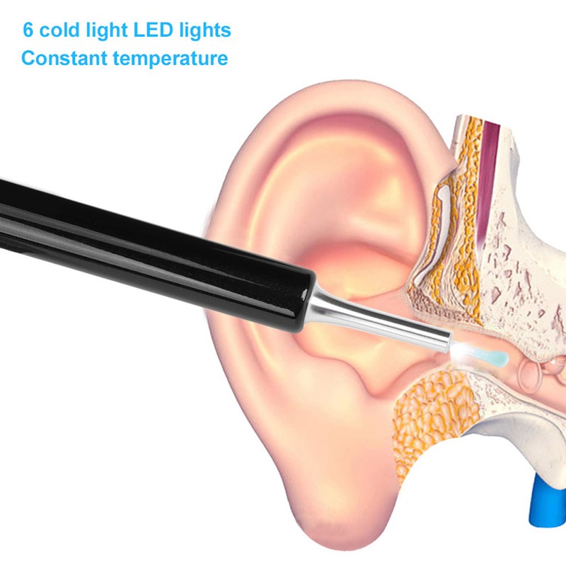 Bebird C3 1080P HD WiFi Ear Wax Spoon Cleaner LED