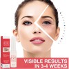 Eye Care for Women, for Moisturising the Skin Around the