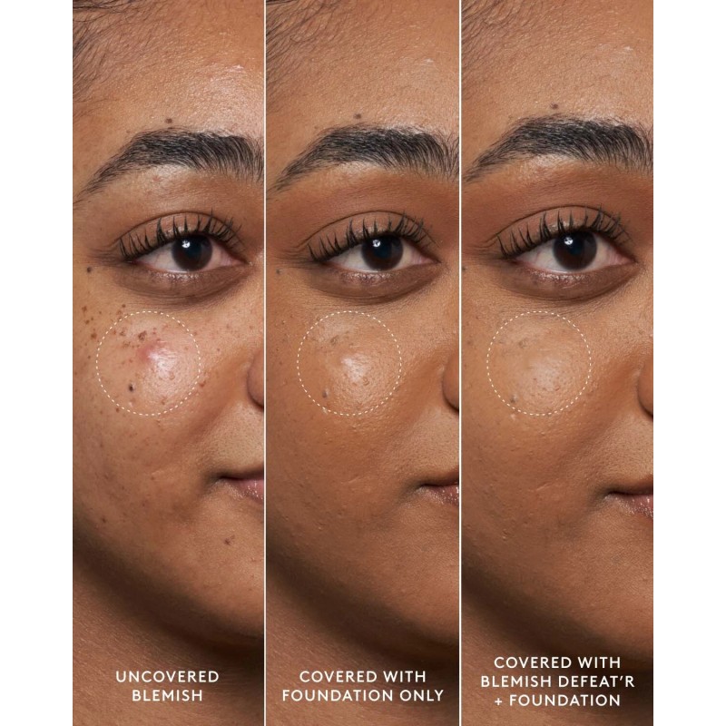 Fenty Skin Blemish Defeat'r BHA Spot-Targeting Gel 0.5 oz /