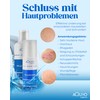 AQUYO Cosmetics Blueline Creme bei Ekzem, Psoriasis, Neurodermitis oder Hautausschlag