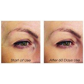 Lycopene Skin Care Wrinkle Eraser - Fight"Crow's Feet" Around Eyes Naturally & Quickly