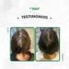 Kit Shampoo Antigrasa Rapunzel + Acondicionador De Regalo
