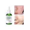 Liquido Antiacne Serum Reparador Espinillas Acido Salicilico
