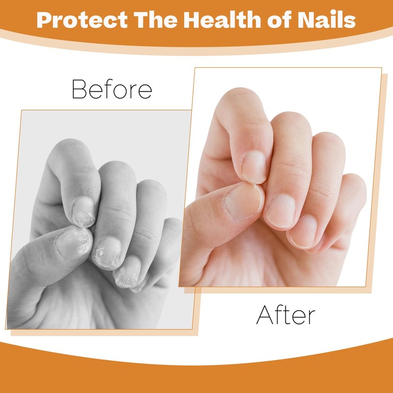 Toe Nail Files for Thick Nails,Professional Stainless Steel Nail File